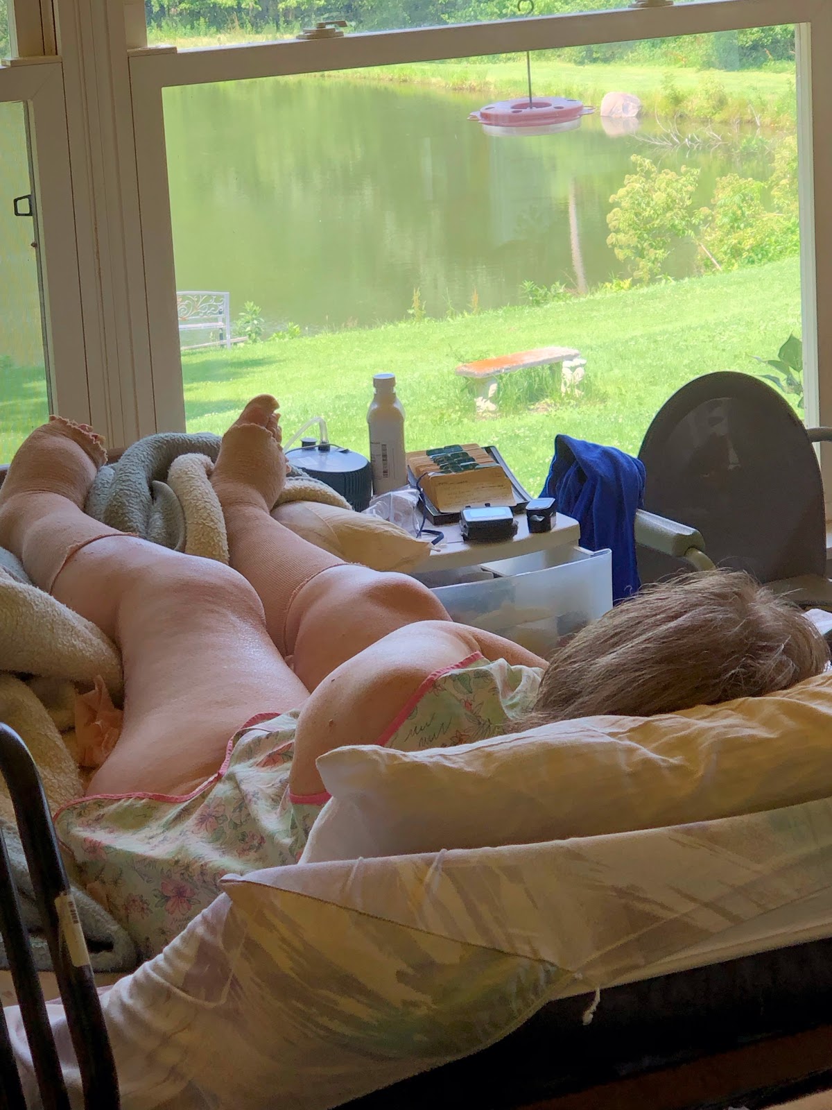 Person lying in bed with bandaged legs near a large window overlooking a green lawn and pond with a red bird feeder.